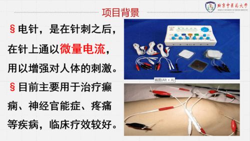 双创大赛 决赛优秀项目展示第一期,你pick谁